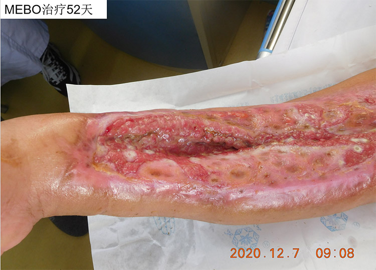 首页-BB贝博艾弗森公司官网