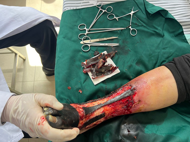 首页-BB贝博艾弗森公司官网